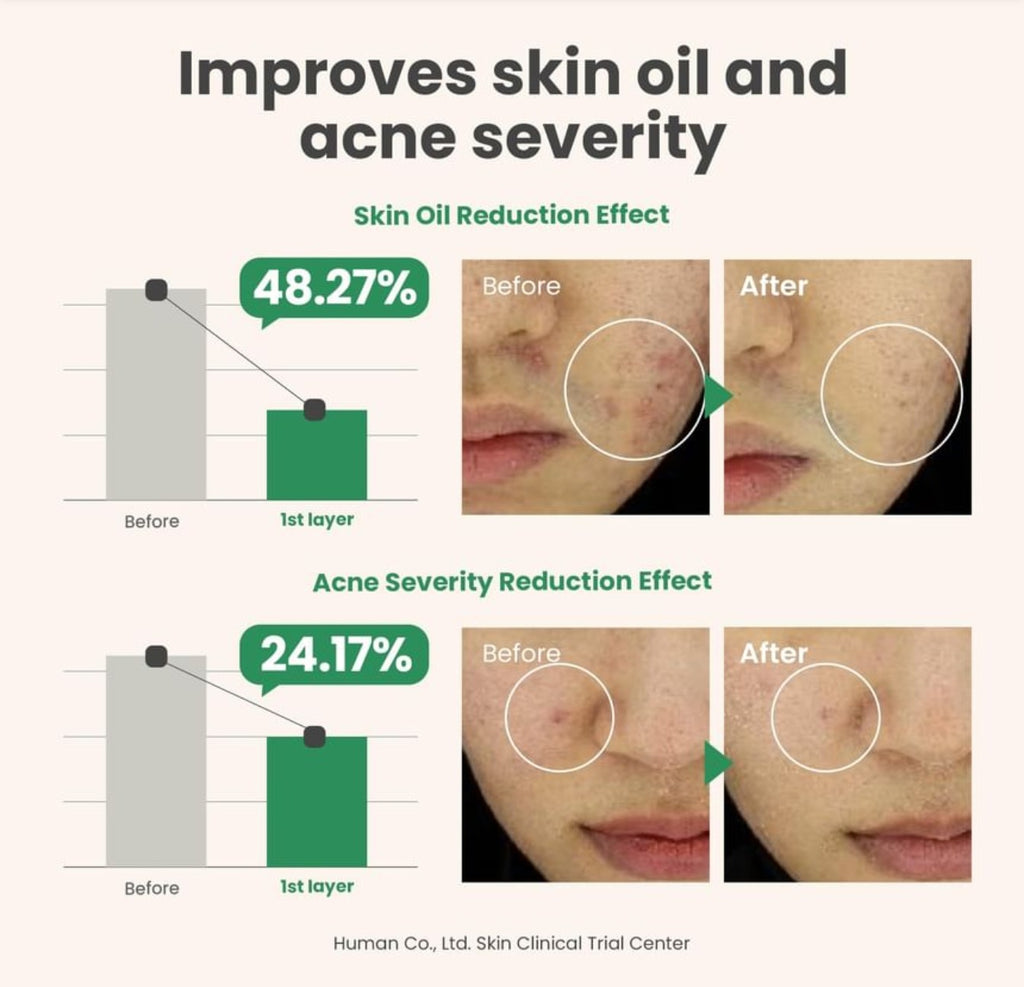 AXIS-Y Spot The Difference Blemish Treatment