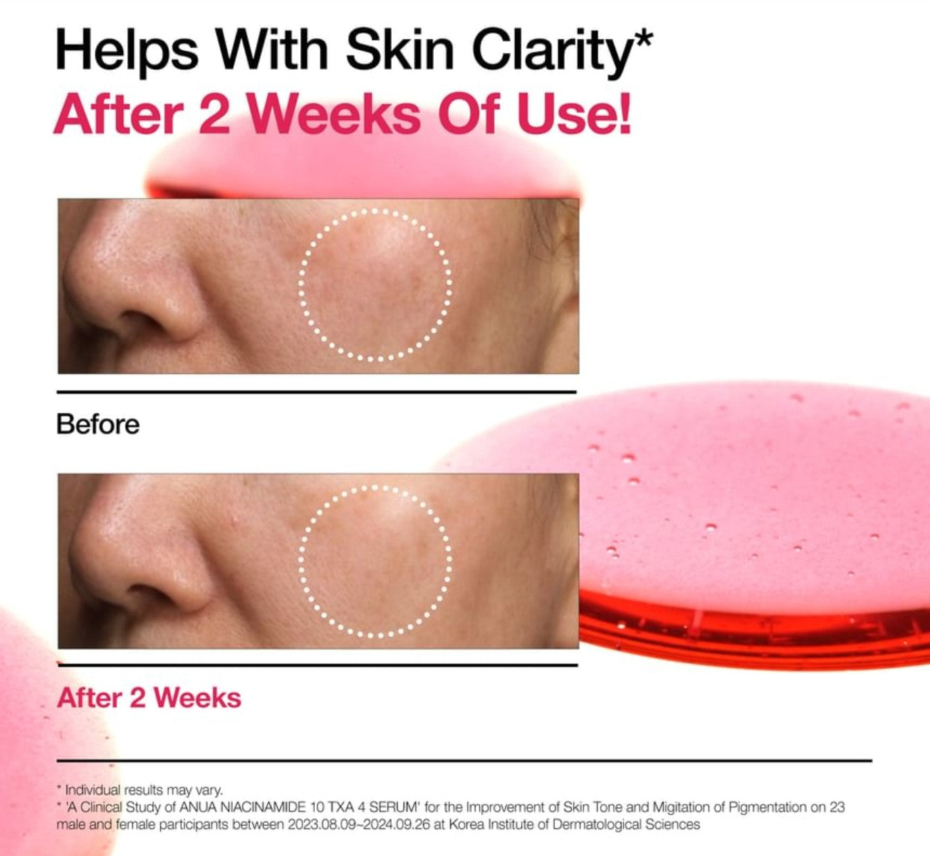 Anua Niacinamide 10% + TXA 4 Serum (30ml)