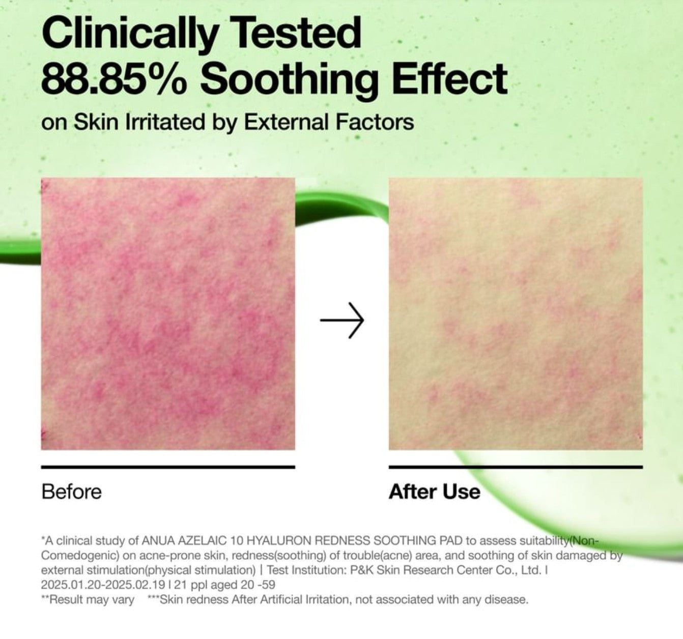 Anua Azelaic 10 Hyaluron Redness Soothing Pad