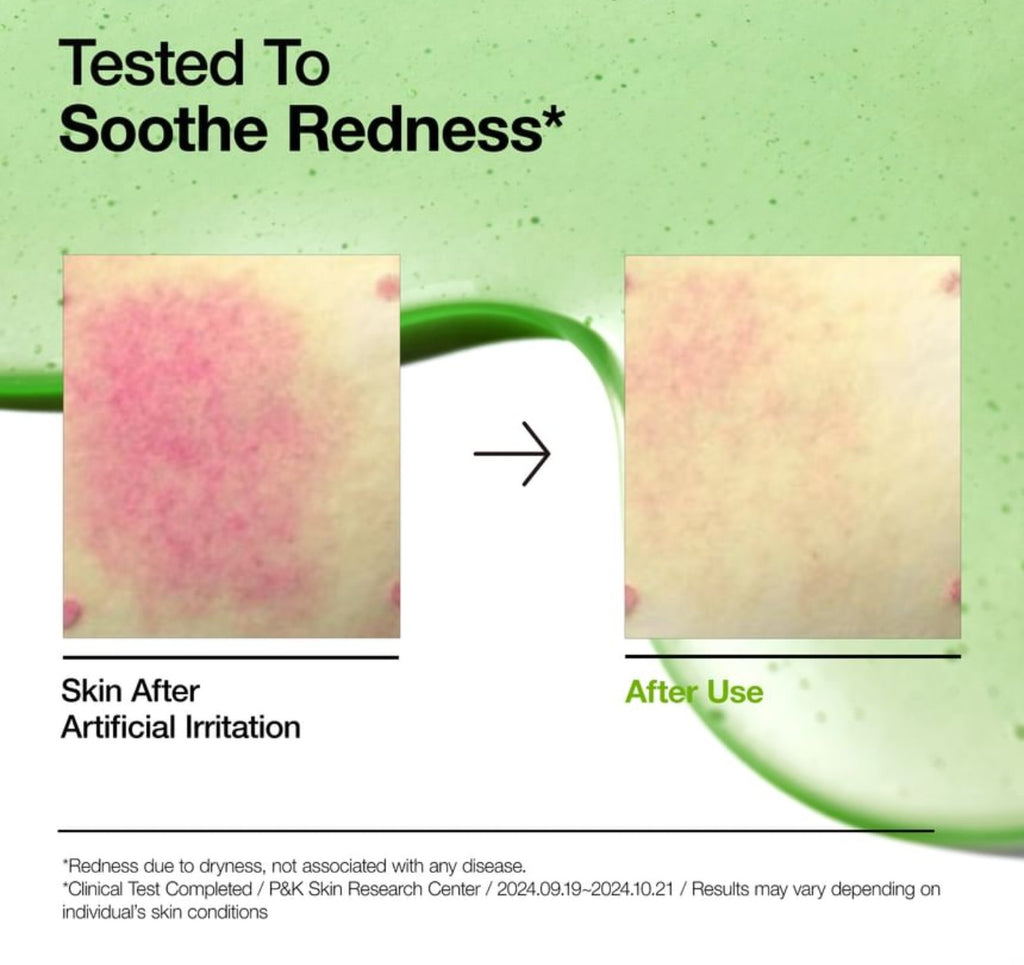 Anua Azelaic Acid 10 + Hyaluron Redness Soothing Serum (30ml)