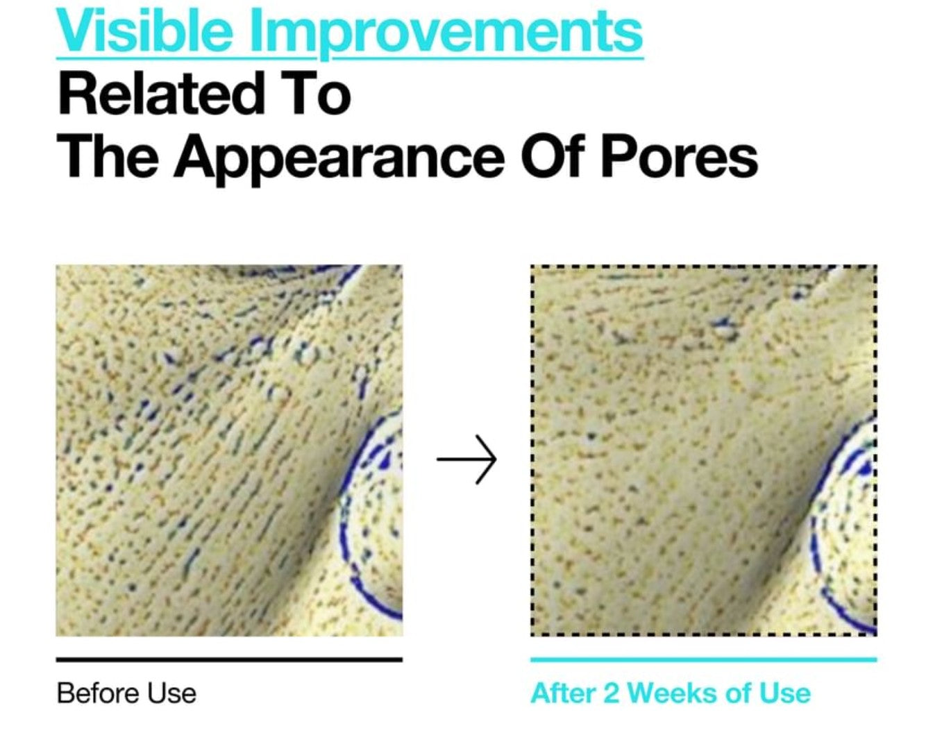 Anua BHA 2% Gentle Exfoliating Toner